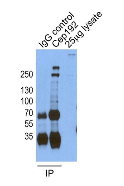 Immunoprecipitation (IP) experiment of HeLa cells using CEP192 Polyclonal antibody (18832-1-AP)