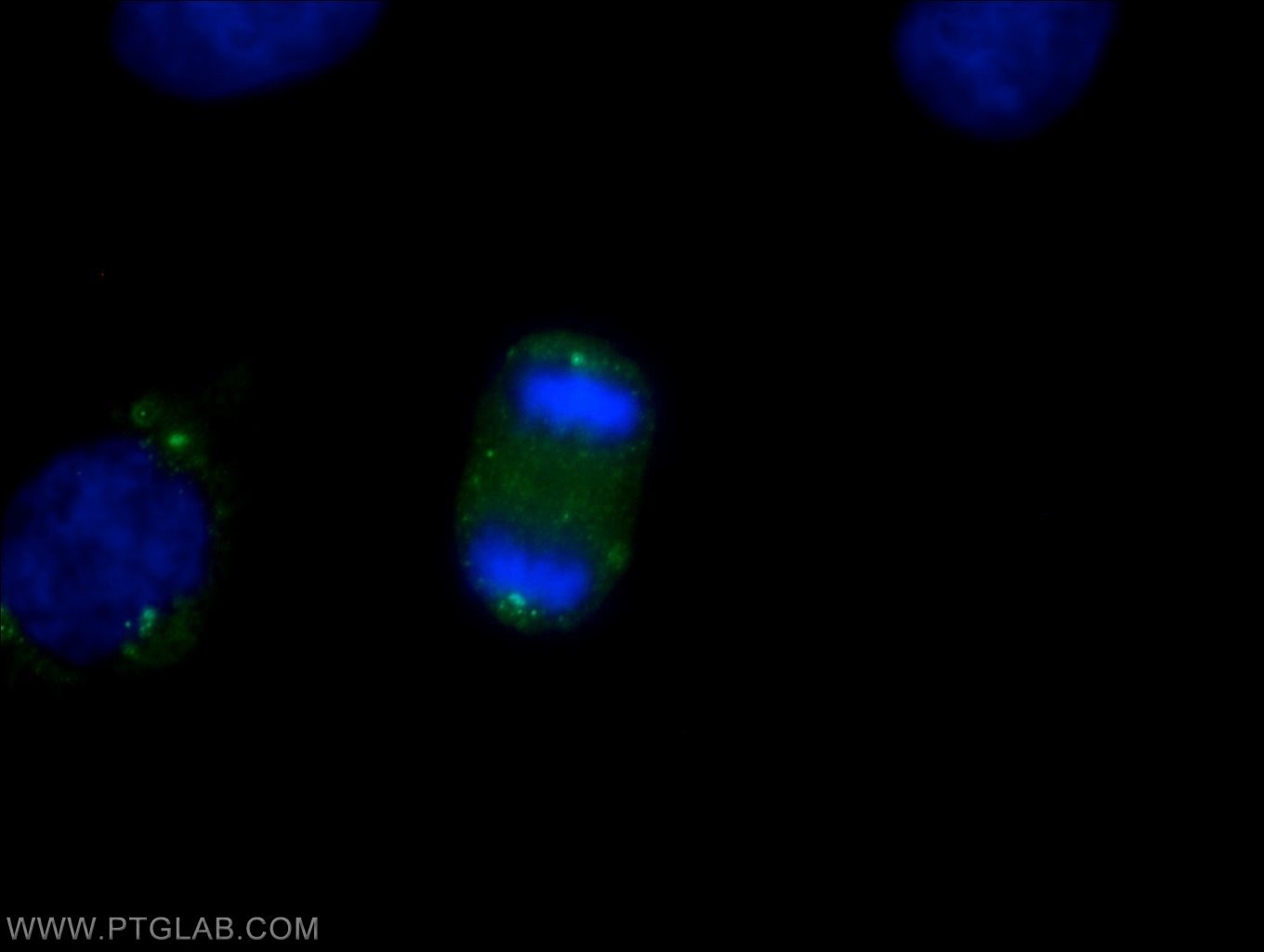 Immunofluorescence (IF) / fluorescent staining of HeLa cells using CEP192 Polyclonal antibody (18832-1-AP)