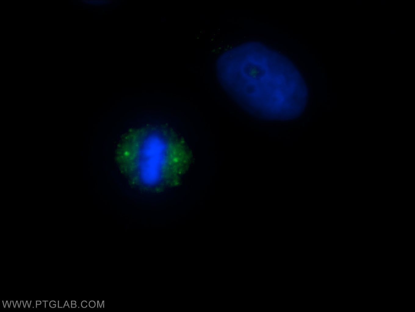 IF Staining of HeLa using 18832-1-AP