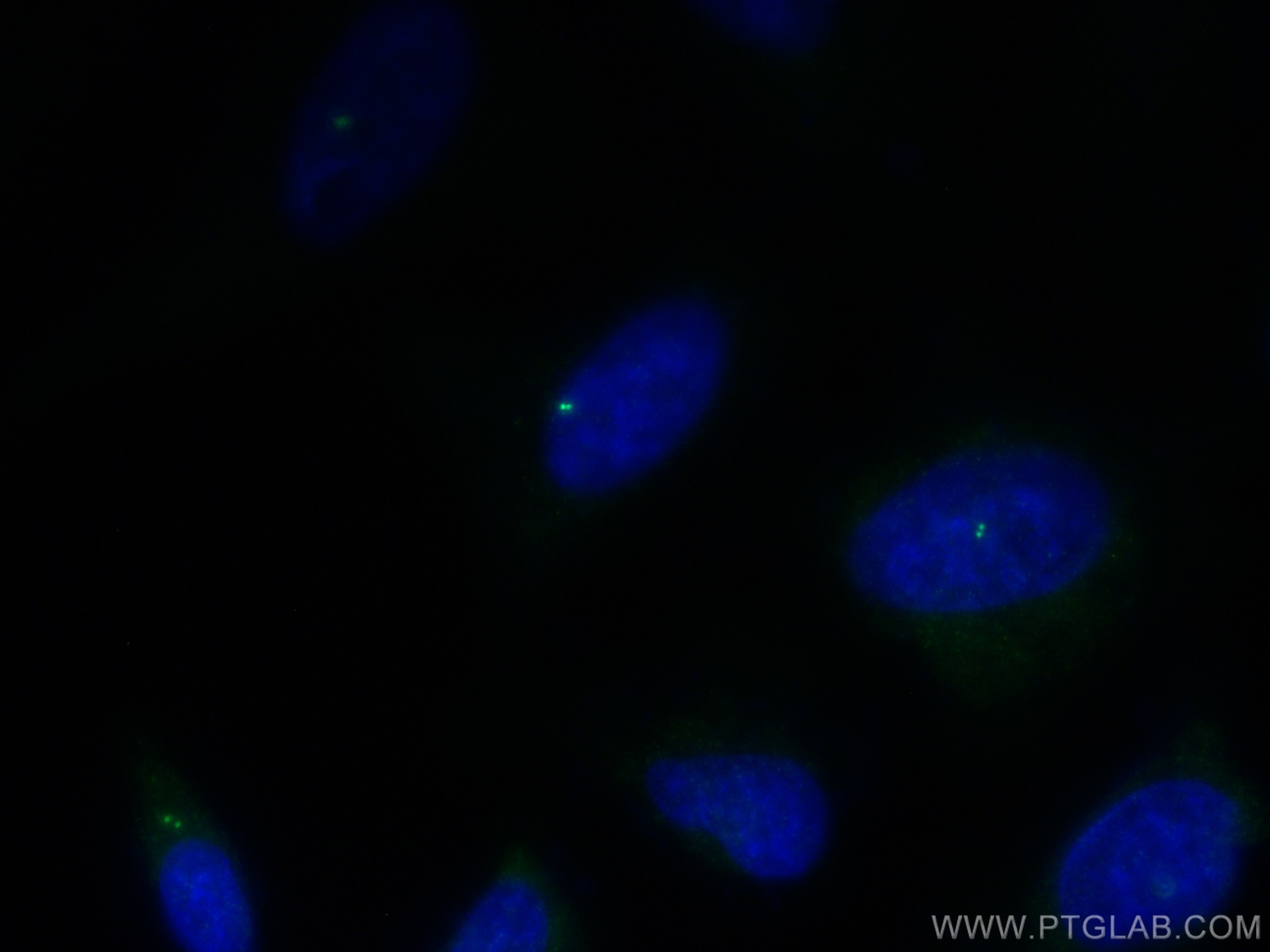 Immunofluorescence (IF) / fluorescent staining of HeLa cells using CEP192 Polyclonal antibody (18832-1-AP)