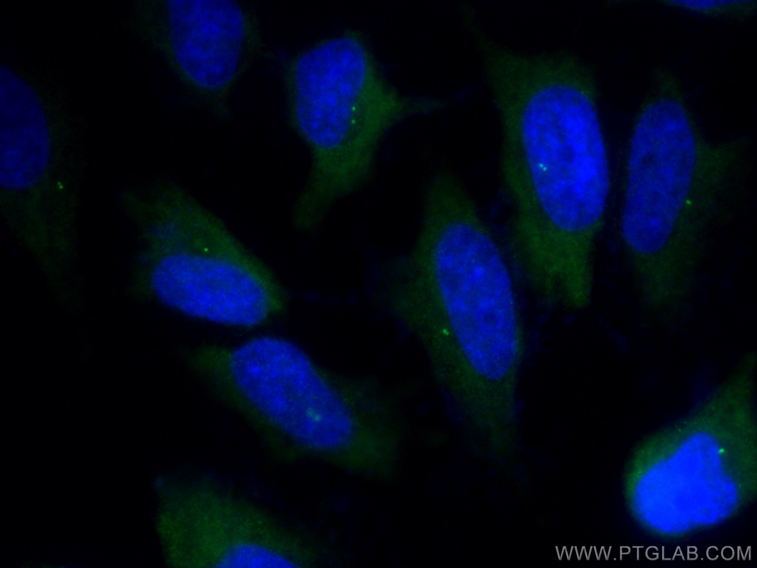 Immunofluorescence (IF) / fluorescent staining of HeLa cells using CEP192 Polyclonal antibody (28700-1-AP)