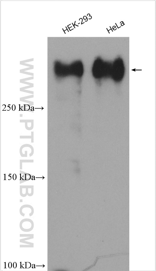 Western Blot (WB) analysis of various lysates using CEP192 Polyclonal antibody (28700-1-AP)