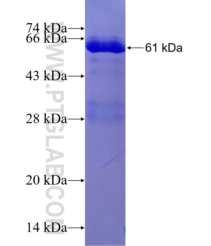 CEP192 fusion protein Ag29930 SDS-PAGE