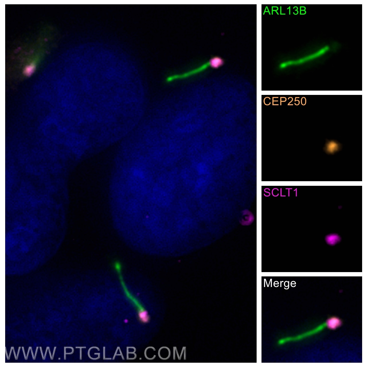 Immunofluorescence (IF) / fluorescent staining of hTERT-RPE1 cells using CEP250/CNAP1 Polyclonal antibody (14498-1-AP)