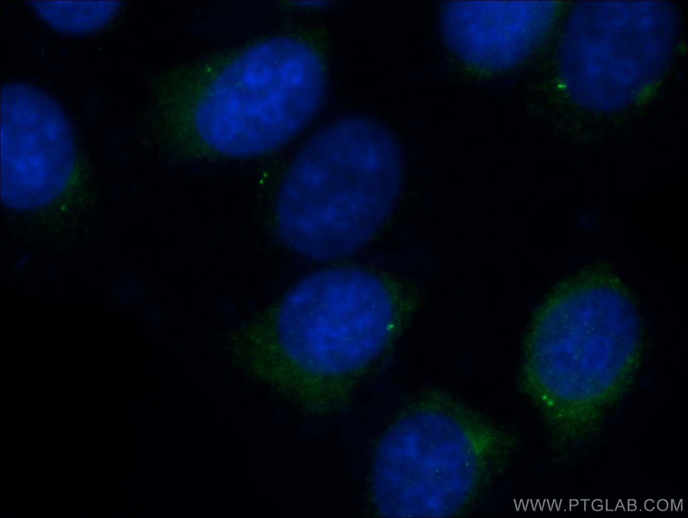 Immunofluorescence (IF) / fluorescent staining of HeLa cells using CEP250/CNAP1 Polyclonal antibody (14498-1-AP)