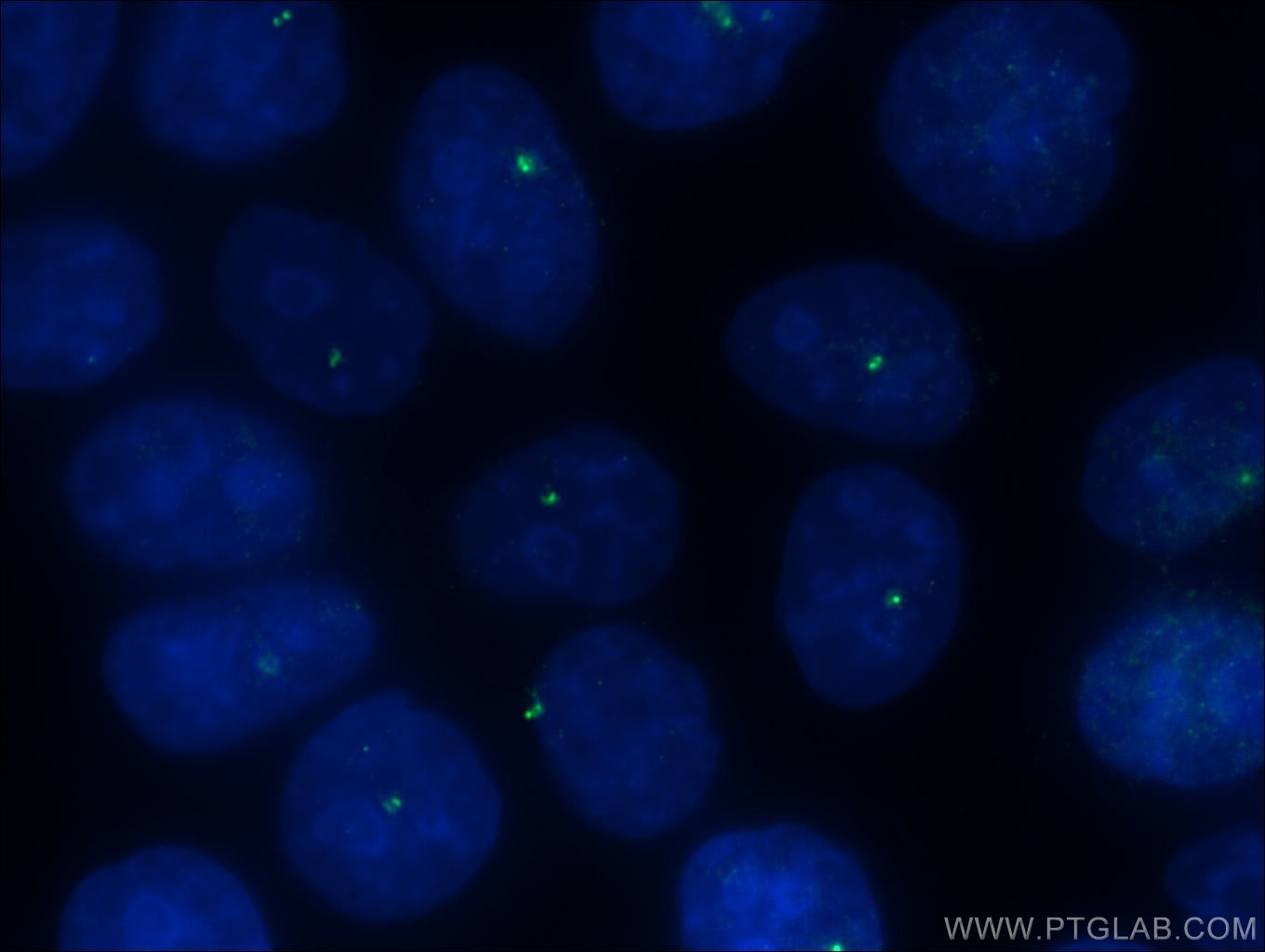 Immunofluorescence (IF) / fluorescent staining of HeLa cells using CEP250/CNAP1 Polyclonal antibody (14498-1-AP)