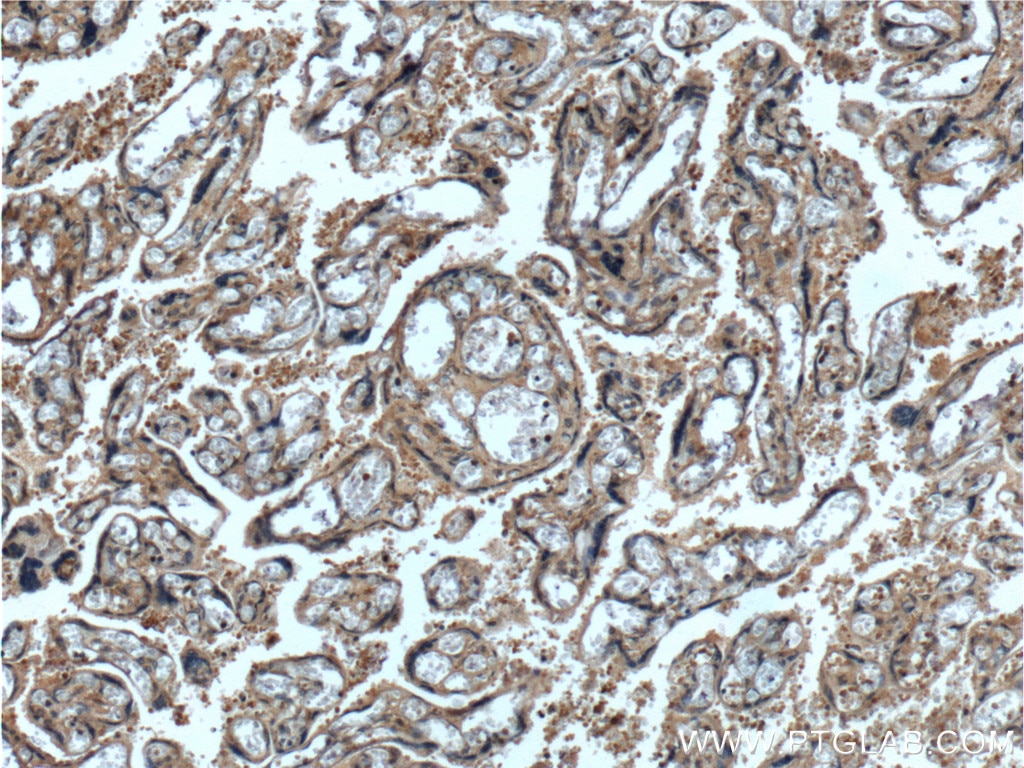 Immunohistochemistry (IHC) staining of human placenta tissue using CEP250/CNAP1 Polyclonal antibody (14498-1-AP)
