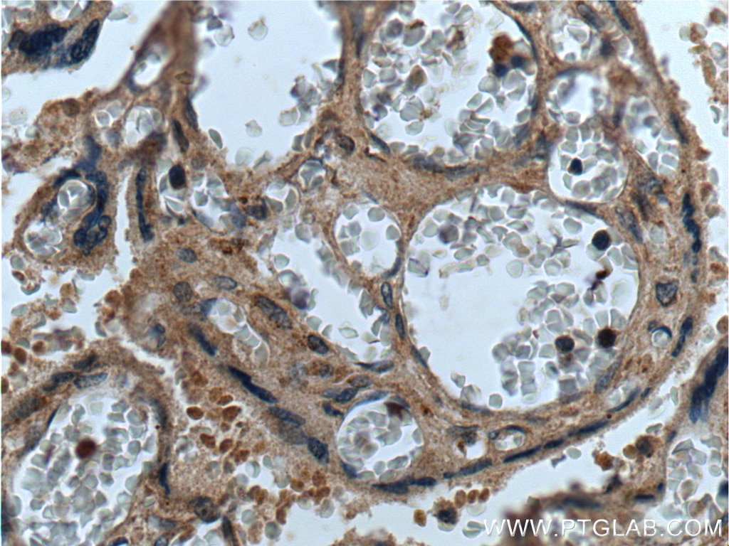 Immunohistochemistry (IHC) staining of human placenta tissue using CEP250/CNAP1 Polyclonal antibody (14498-1-AP)