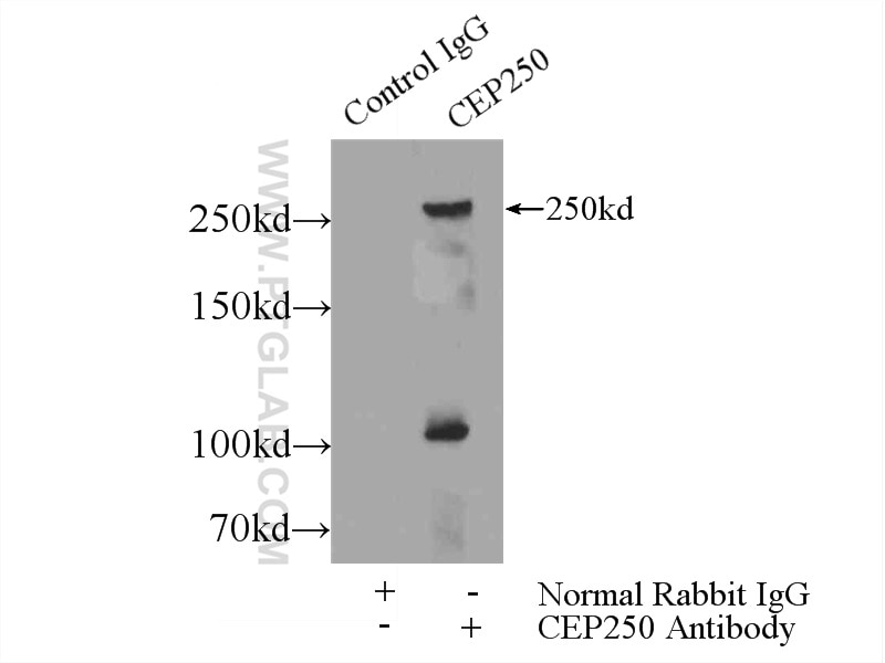 Immunoprecipitation (IP) experiment of HeLa cells using CEP250/CNAP1 Polyclonal antibody (14498-1-AP)