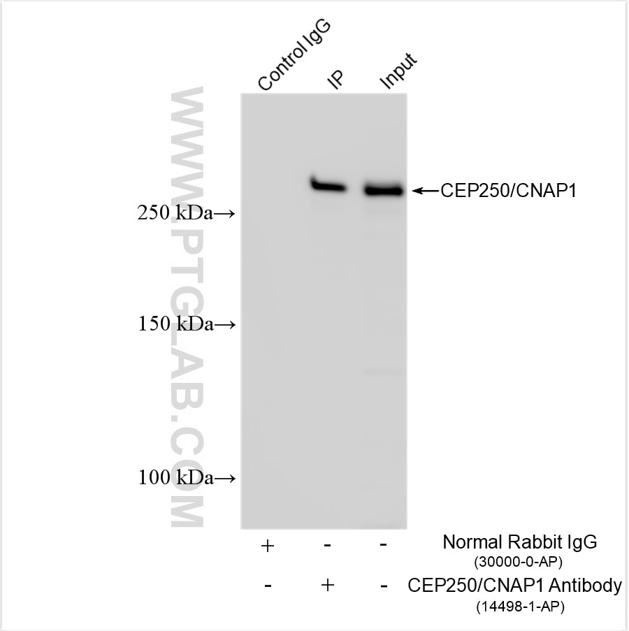 Immunoprecipitation (IP) experiment of HEK-293 cells using CEP250/CNAP1 Polyclonal antibody (14498-1-AP)