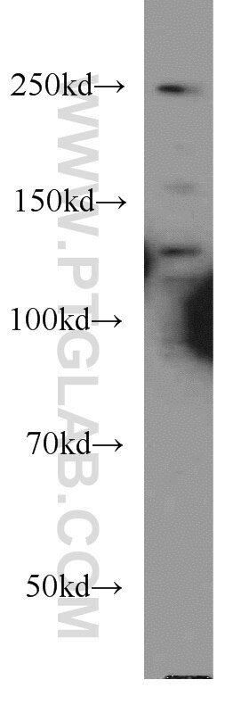 Western Blot (WB) analysis of HeLa cells using CEP250/CNAP1 Polyclonal antibody (14498-1-AP)