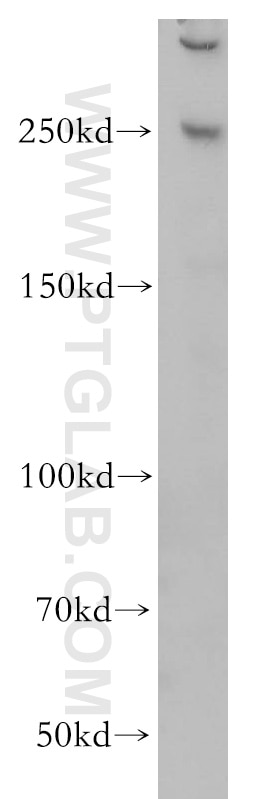 Western Blot (WB) analysis of HeLa cells using CEP250/CNAP1 Polyclonal antibody (14498-1-AP)