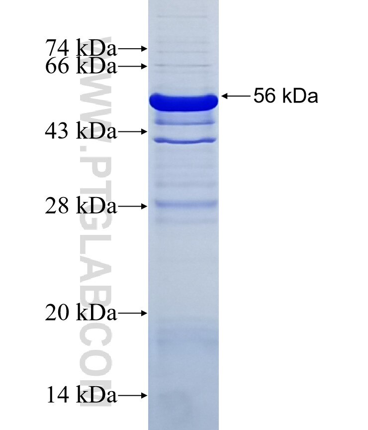 CEP250,C-NAP1 fusion protein Ag0394 SDS-PAGE