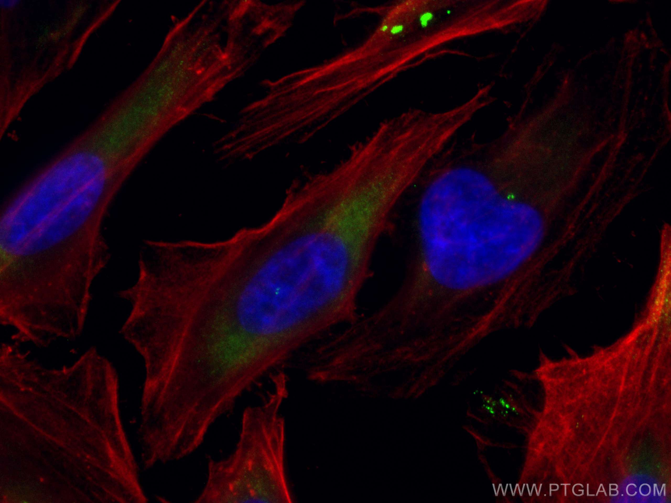 Immunofluorescence (IF) / fluorescent staining of HeLa cells using CoraLite® Plus 488-conjugated CEP250/CNAP1 Polyclo (CL488-14498)