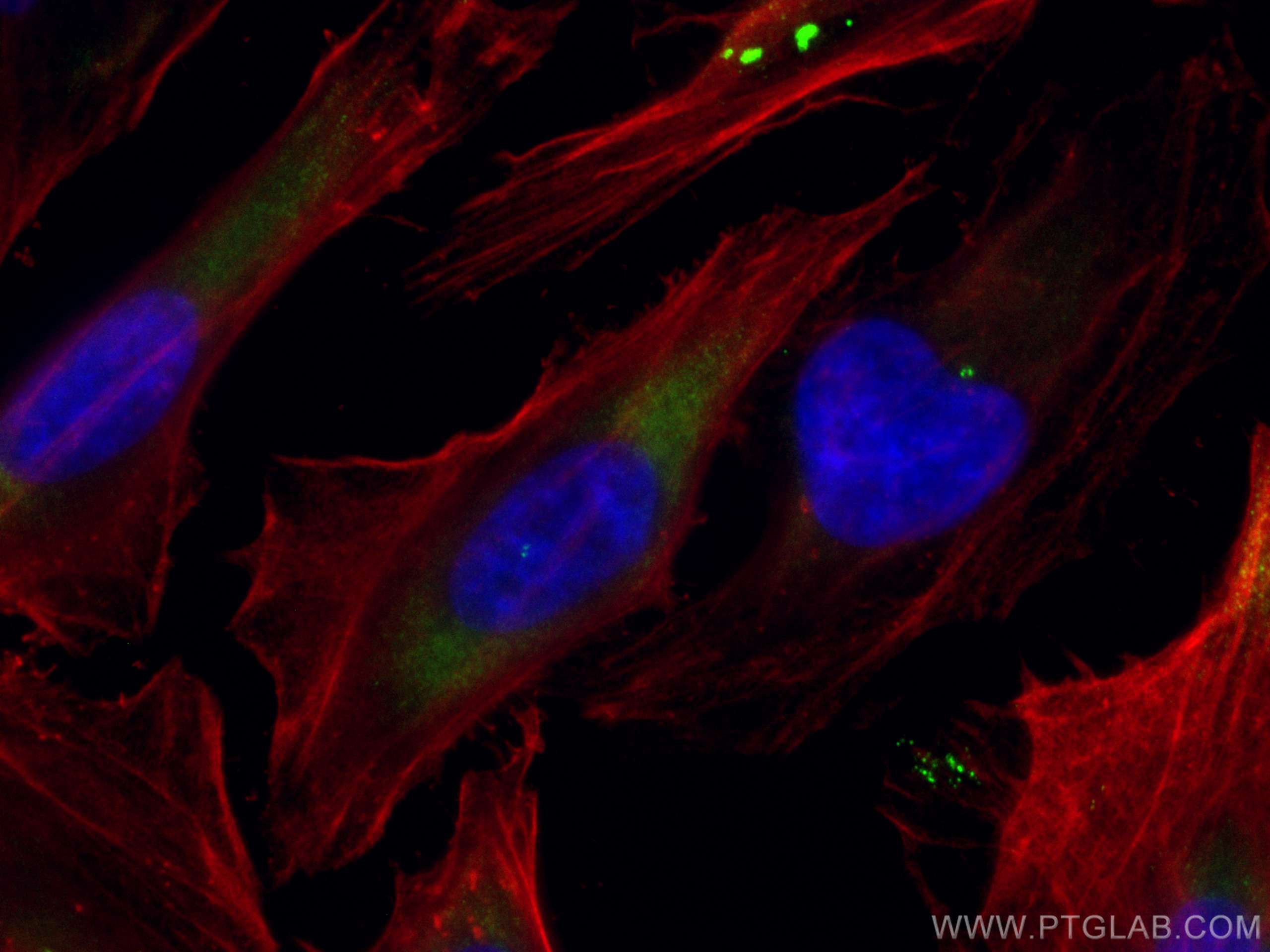 IF Staining of HeLa using CL488-14498