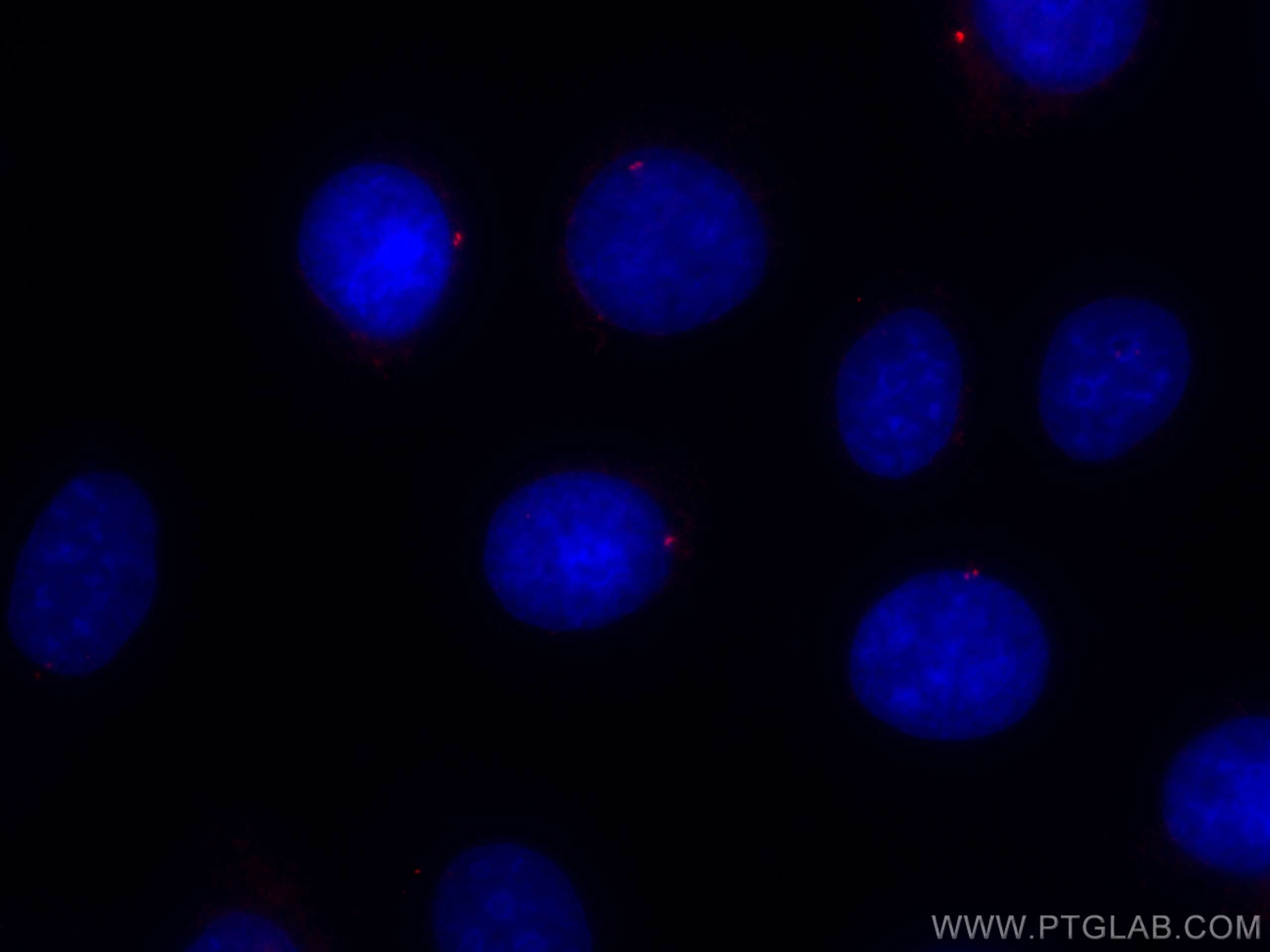 Immunofluorescence (IF) / fluorescent staining of MCF-7 cells using CoraLite®594-conjugated CEP250/CNAP1 Polyclonal an (CL594-14498)