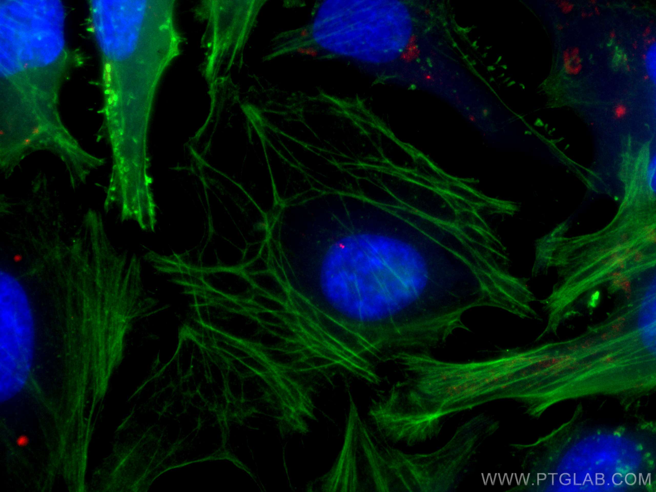 Immunofluorescence (IF) / fluorescent staining of HeLa cells using CoraLite®594-conjugated CEP250/CNAP1 Polyclonal an (CL594-14498)