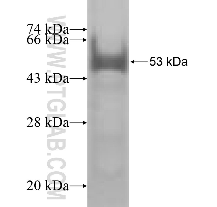 CEP27 fusion protein Ag8898 SDS-PAGE