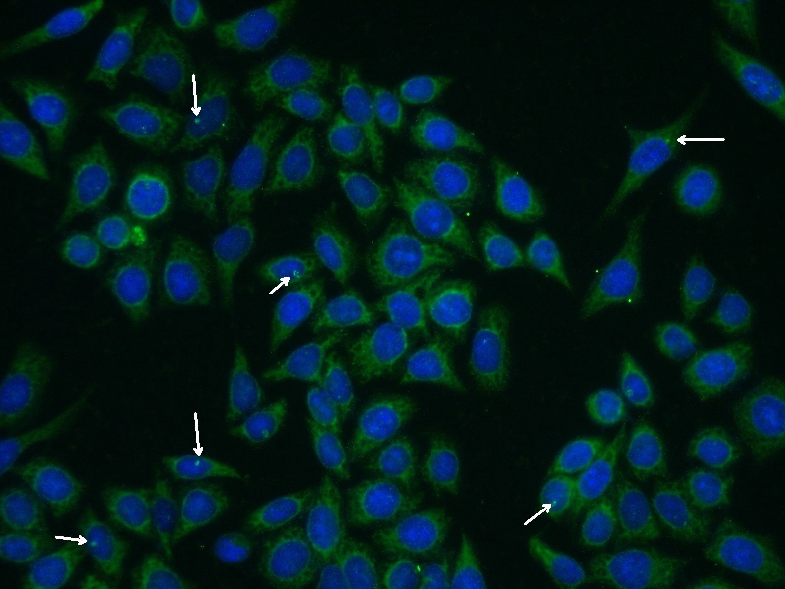 Immunofluorescence (IF) / fluorescent staining of HeLa cells using CEP290 Polyclonal antibody (22490-1-AP)