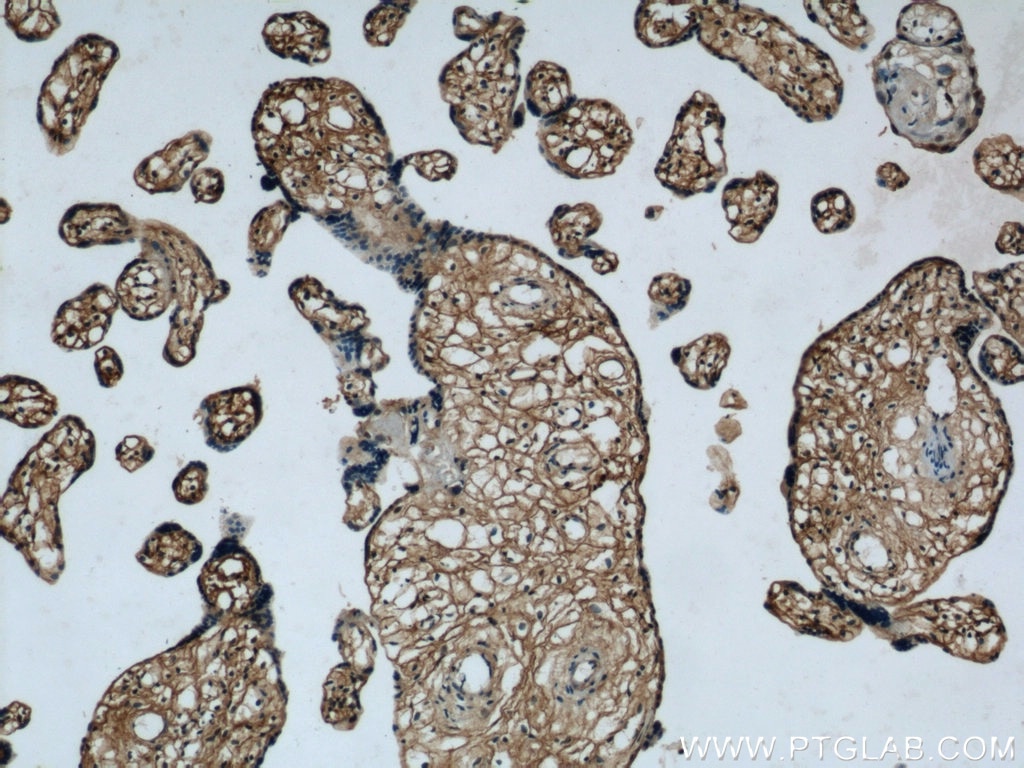 Immunohistochemistry (IHC) staining of human placenta tissue using CEP290 Polyclonal antibody (22490-1-AP)