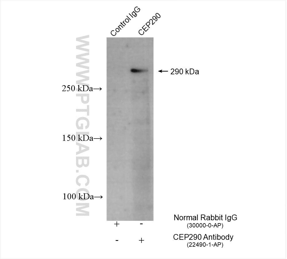 Immunoprecipitation (IP) experiment of HeLa cells using CEP290 Polyclonal antibody (22490-1-AP)