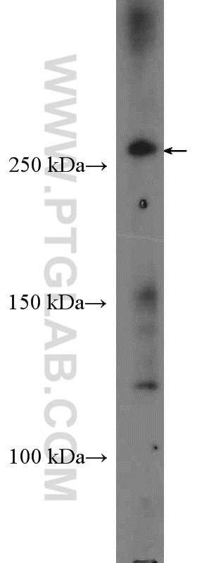 Western Blot (WB) analysis of HeLa cells using CEP290 Polyclonal antibody (22490-1-AP)