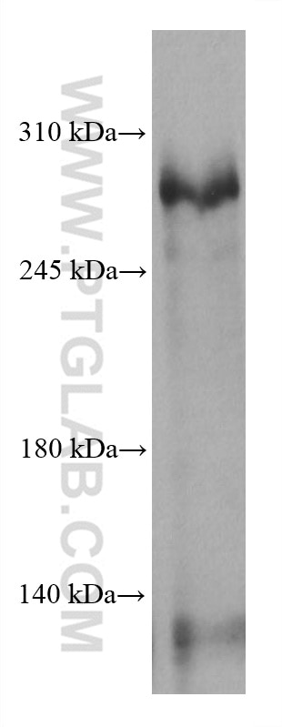 Western Blot (WB) analysis of HSC-T6 cells using CEP290 Monoclonal antibody (67716-1-Ig)