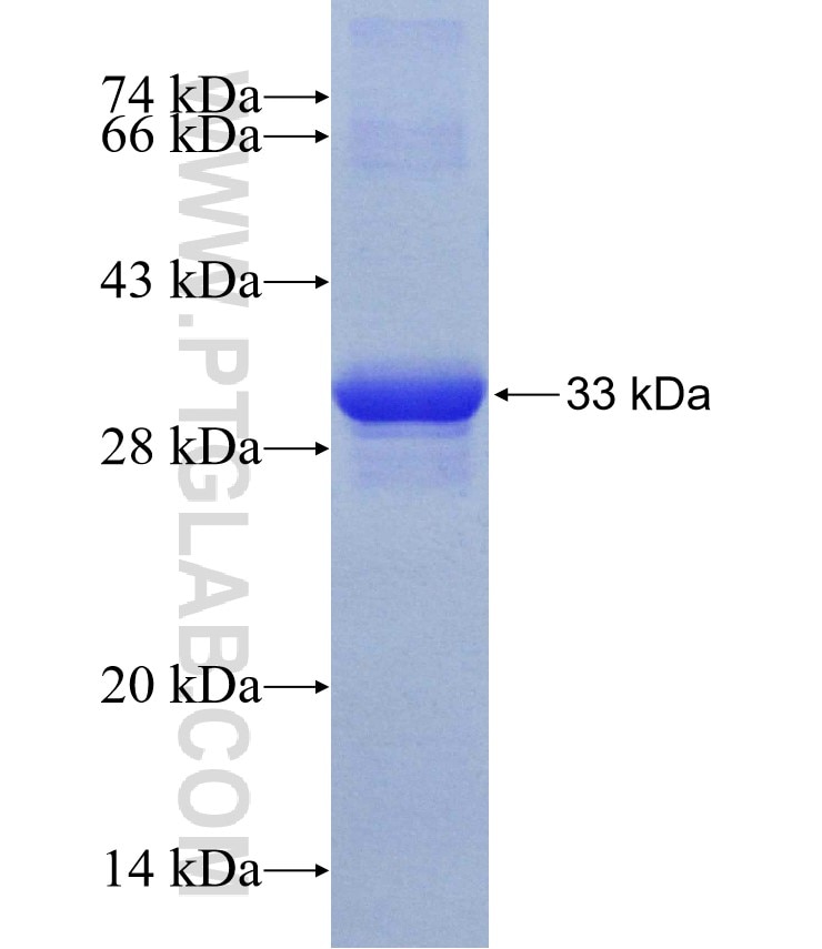 CEP290 fusion protein Ag17457 SDS-PAGE