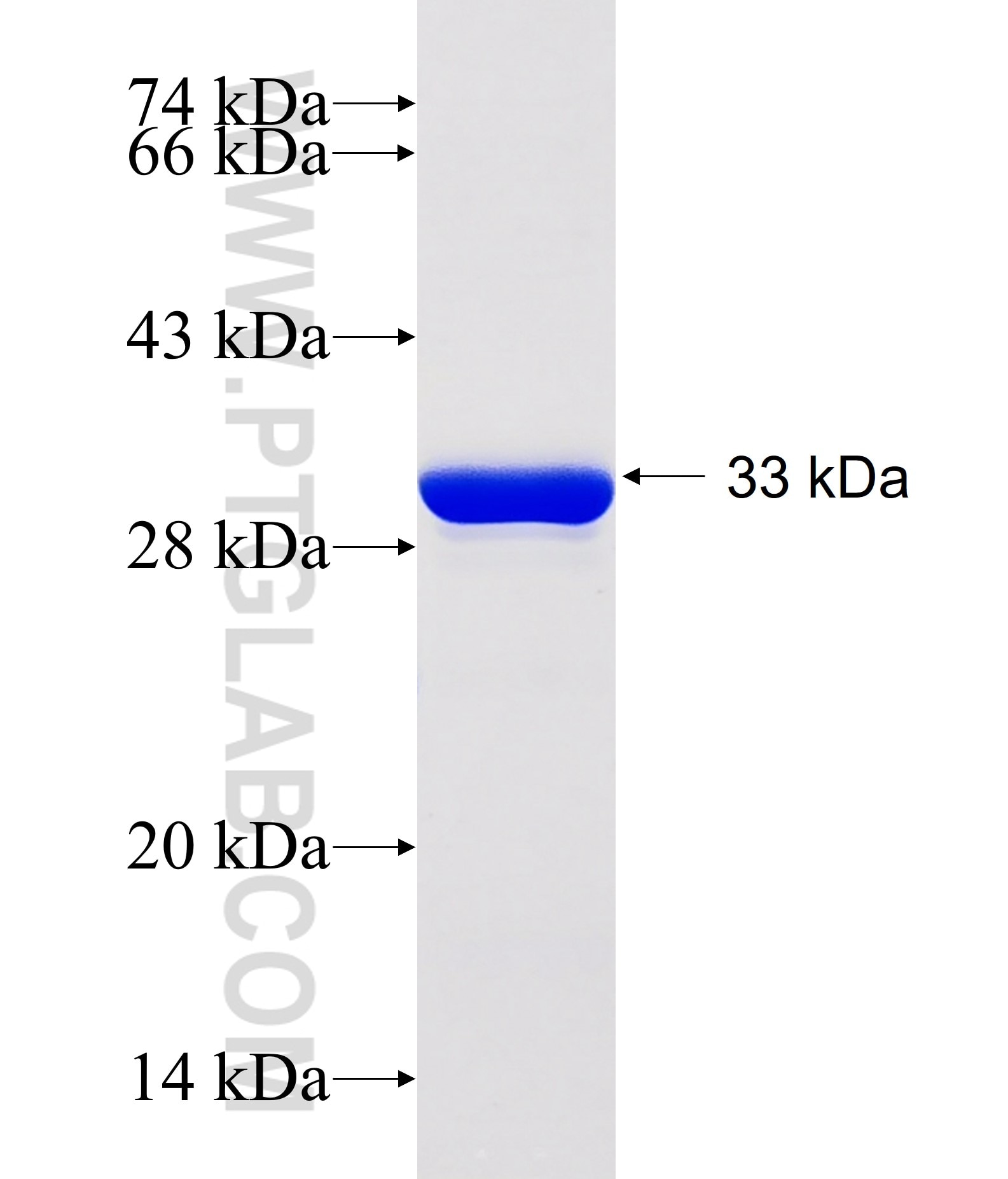 CEP290 fusion protein Ag17457 SDS-PAGE