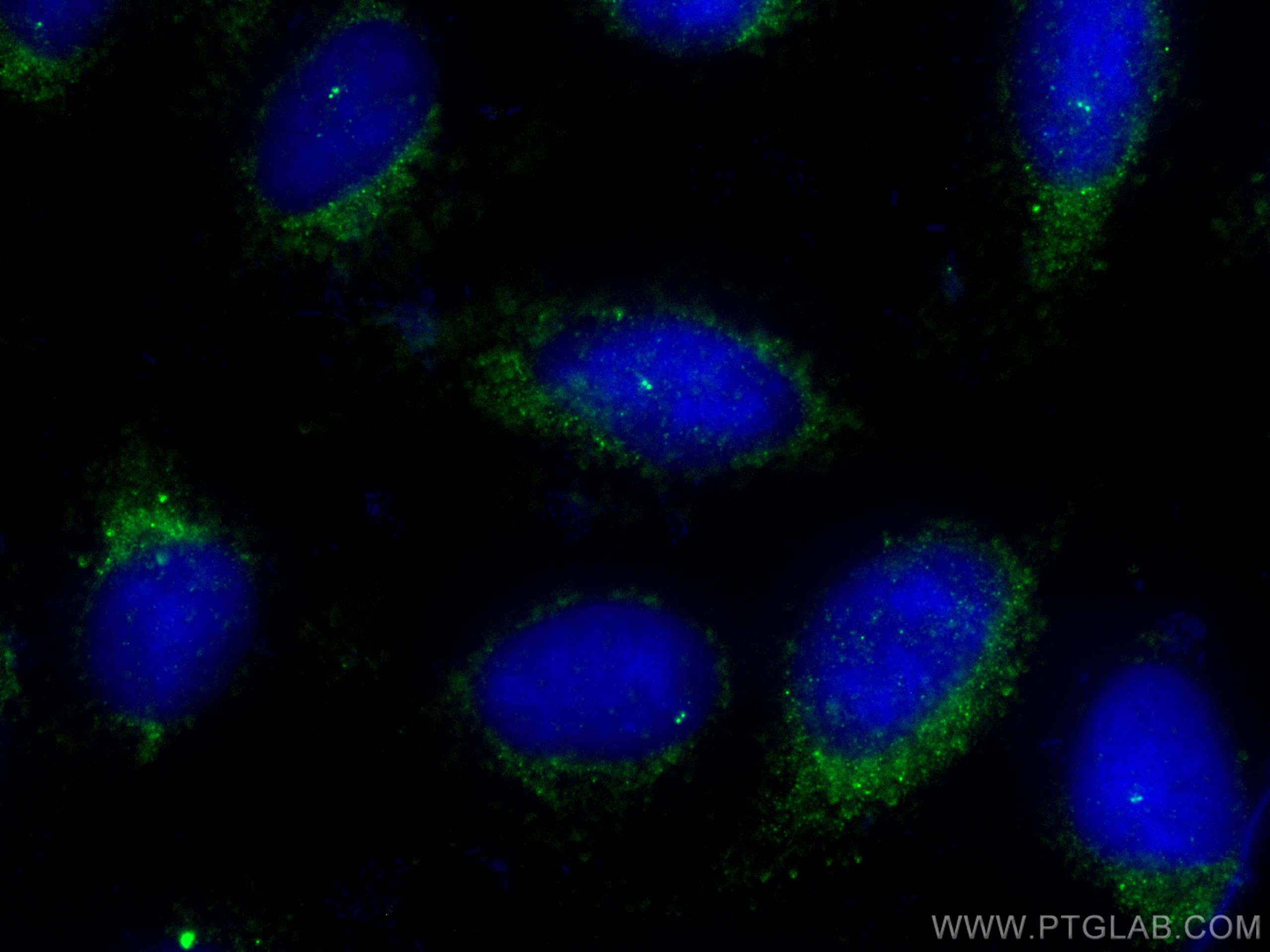 Immunofluorescence (IF) / fluorescent staining of U2OS cells using CEP295 Polyclonal antibody (30446-1-AP)