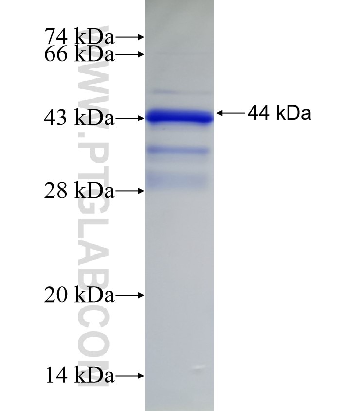 CEP295 fusion protein Ag32896 SDS-PAGE