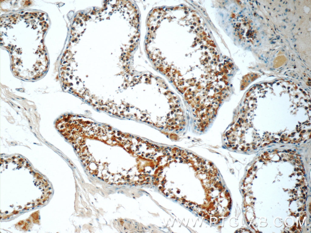 Immunohistochemistry (IHC) staining of human testis tissue using CEP55 Polyclonal antibody (23891-1-AP)
