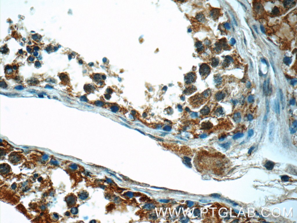 IHC staining of human testis using 23891-1-AP