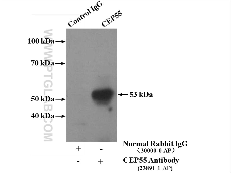 Immunoprecipitation (IP) experiment of mouse testis tissue using CEP55 Polyclonal antibody (23891-1-AP)