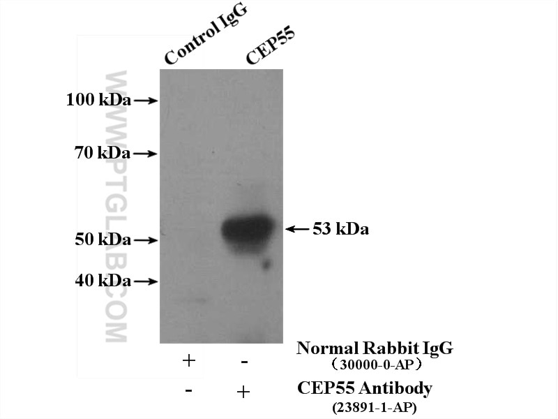 IP experiment of mouse testis using 23891-1-AP