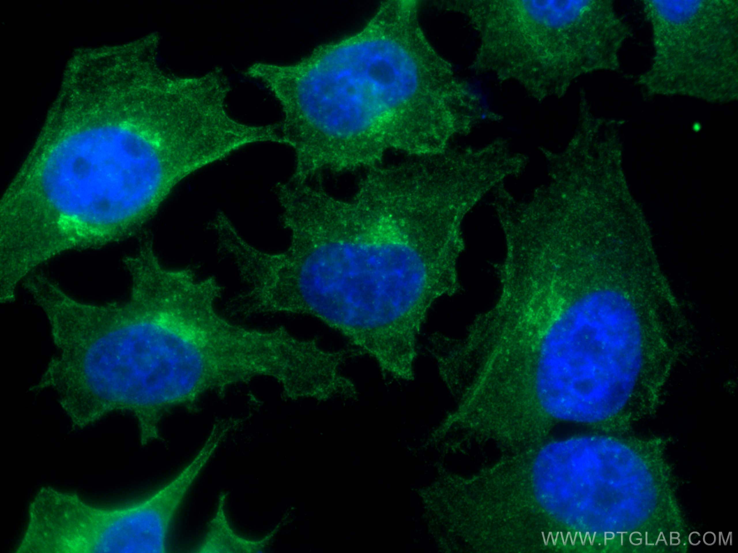 Immunofluorescence (IF) / fluorescent staining of HeLa cells using CEP55 Monoclonal antibody (67460-1-Ig)