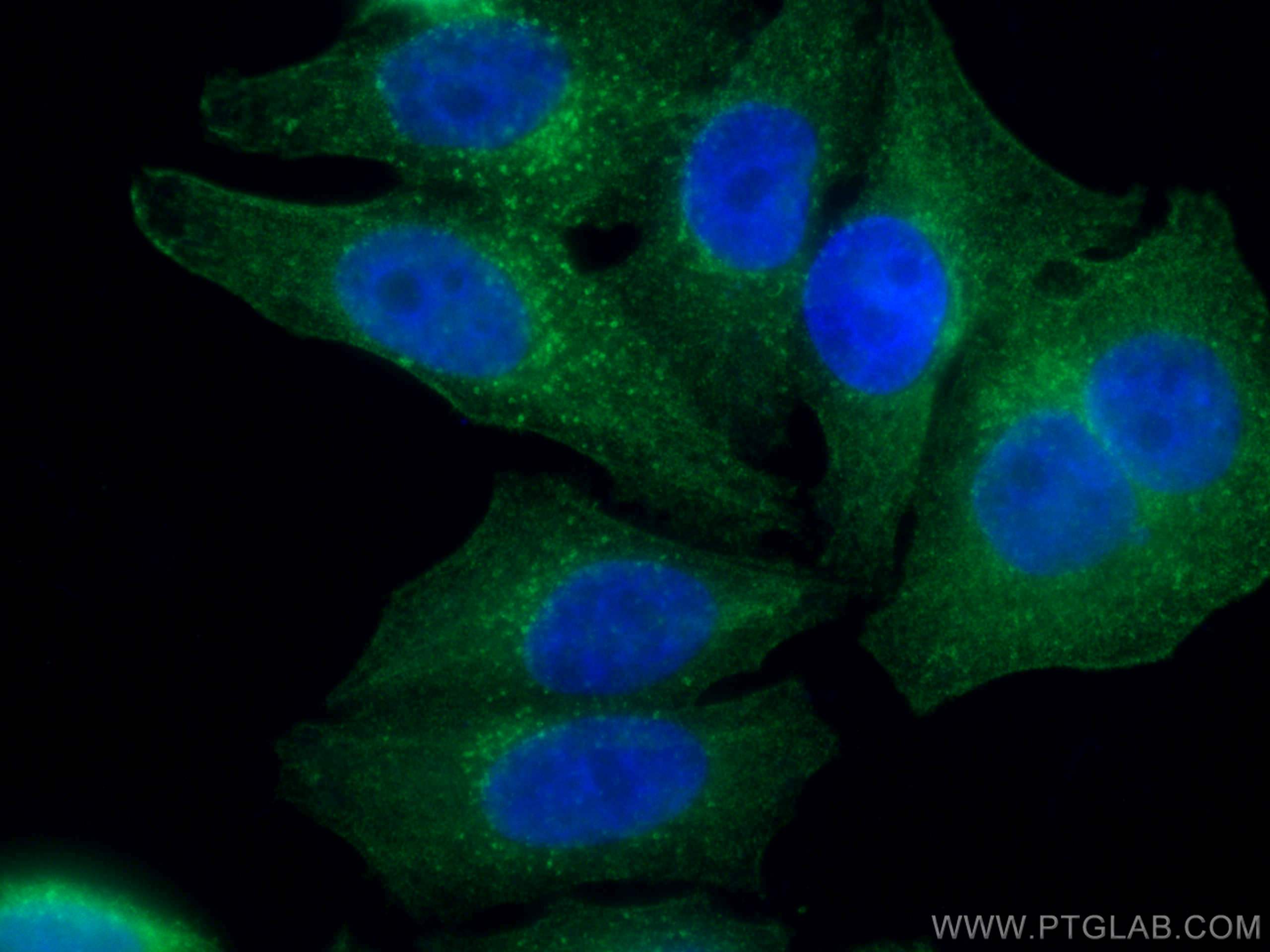 Immunofluorescence (IF) / fluorescent staining of HepG2 cells using CEP55 Monoclonal antibody (67460-1-Ig)