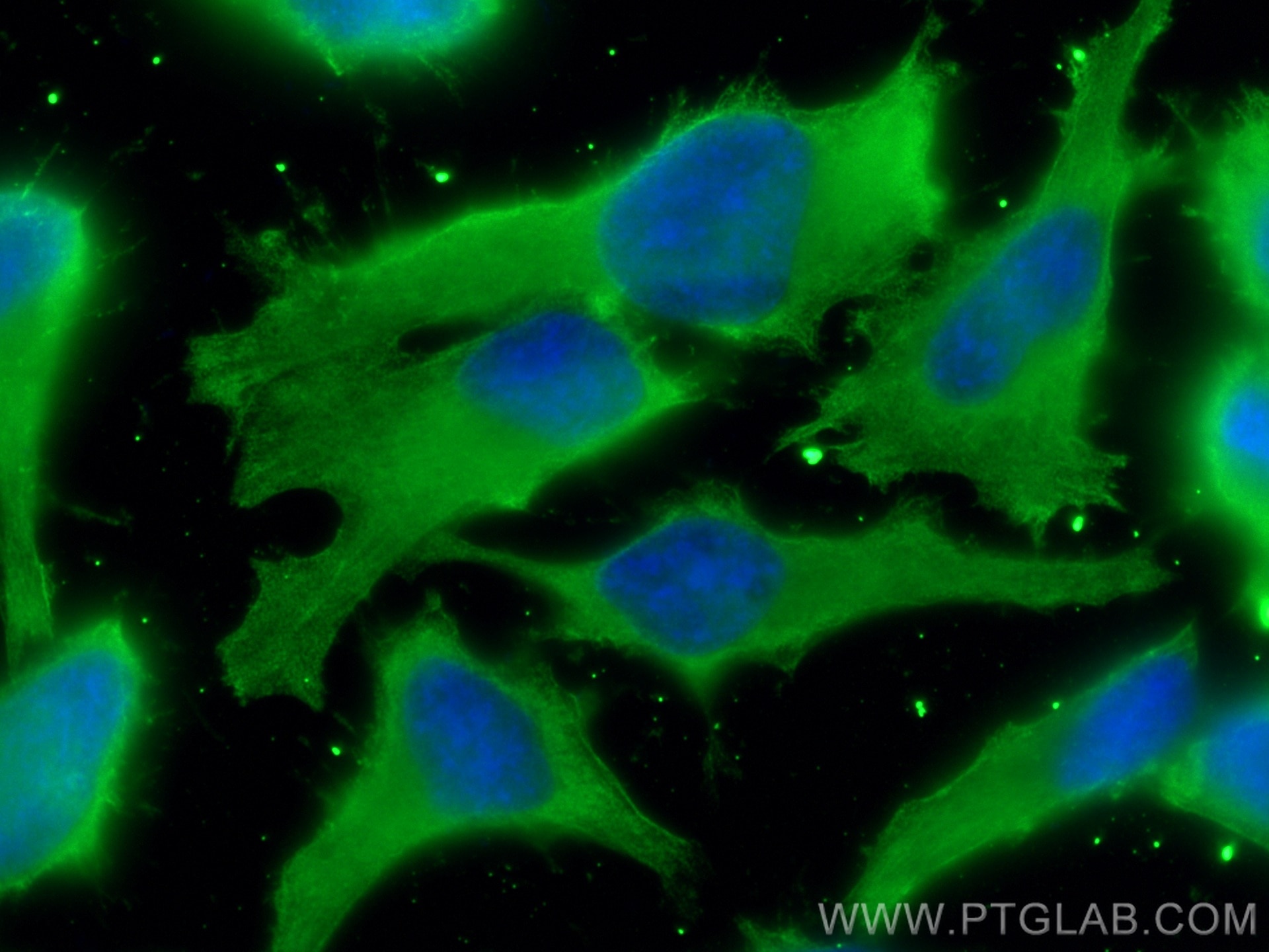 Immunofluorescence (IF) / fluorescent staining of HeLa cells using CEP55 Monoclonal antibody (67460-1-Ig)