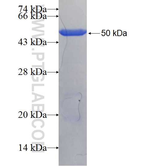 CEP55 fusion protein Ag20940 SDS-PAGE