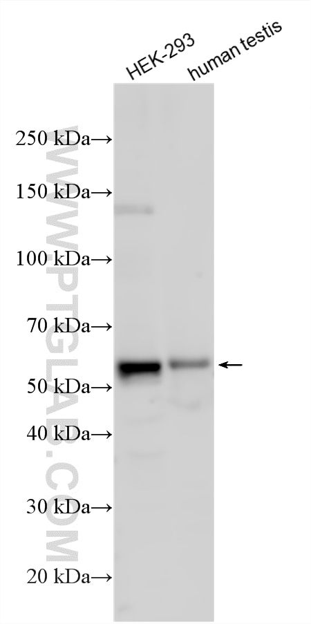 Western Blot (WB) analysis of various lysates using CEP57 Polyclonal antibody (27031-1-AP)
