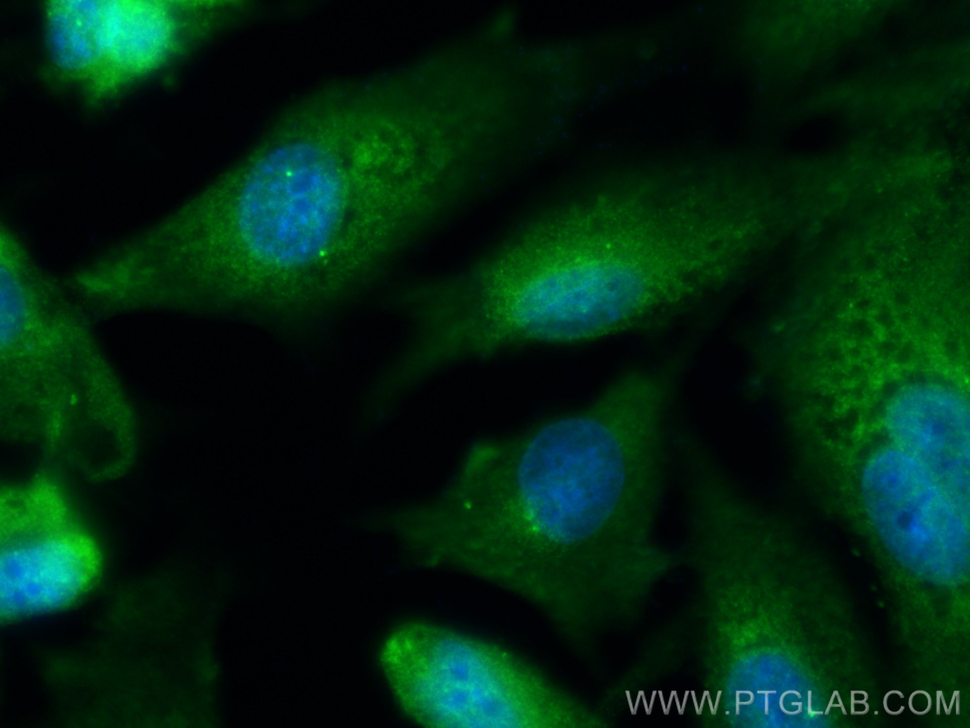 Immunofluorescence (IF) / fluorescent staining of MDCK cells using CEP63 Polyclonal antibody (16268-1-AP)