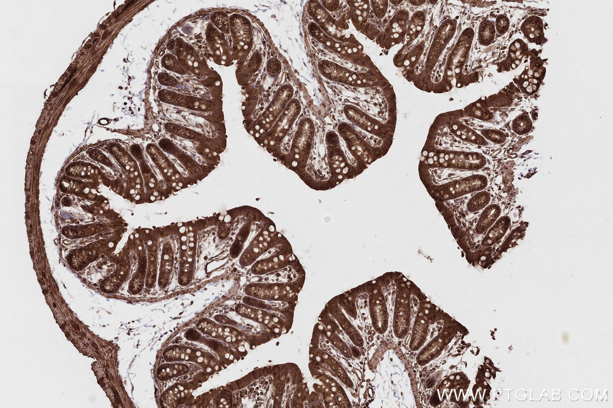 IHC staining of mouse colon using 16268-1-AP Immunohistochemistry (IHC) staining of mouse colon tissue using CEP63 Polyclonal antibody (16268-1-AP)