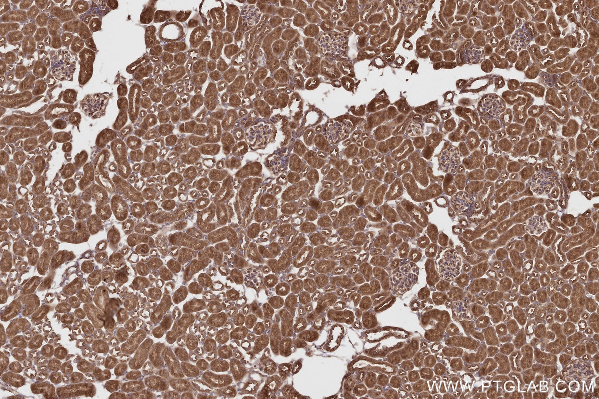 IHC staining of mouse kidney using 16268-1-AP Immunohistochemistry (IHC) staining of mouse kidney tissue using CEP63 Polyclonal antibody (16268-1-AP)