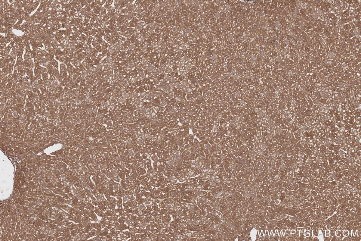 IHC staining of mouse liver using 16268-1-AP Immunohistochemistry (IHC) staining of mouse liver tissue using CEP63 Polyclonal antibody (16268-1-AP)