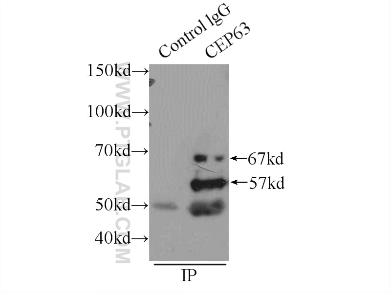 Immunoprecipitation (IP) experiment of HEK-293 cells using CEP63 Polyclonal antibody (16268-1-AP)