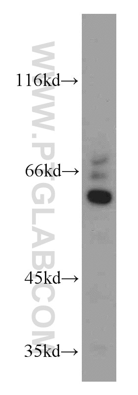 Western Blot (WB) analysis of mouse thymus tissue using CEP63 Polyclonal antibody (16268-1-AP)