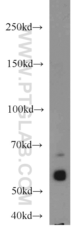 Western Blot (WB) analysis of mouse liver tissue using CEP63 Polyclonal antibody (16268-1-AP)