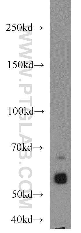 WB analysis of mouse liver using 16268-1-AP