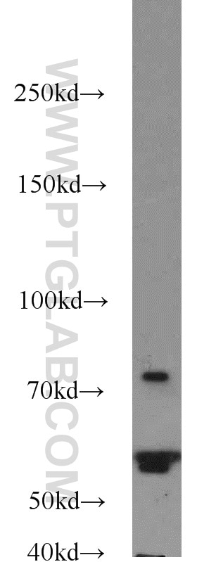 Western Blot (WB) analysis of HeLa cells using CEP63 Polyclonal antibody (16268-1-AP)