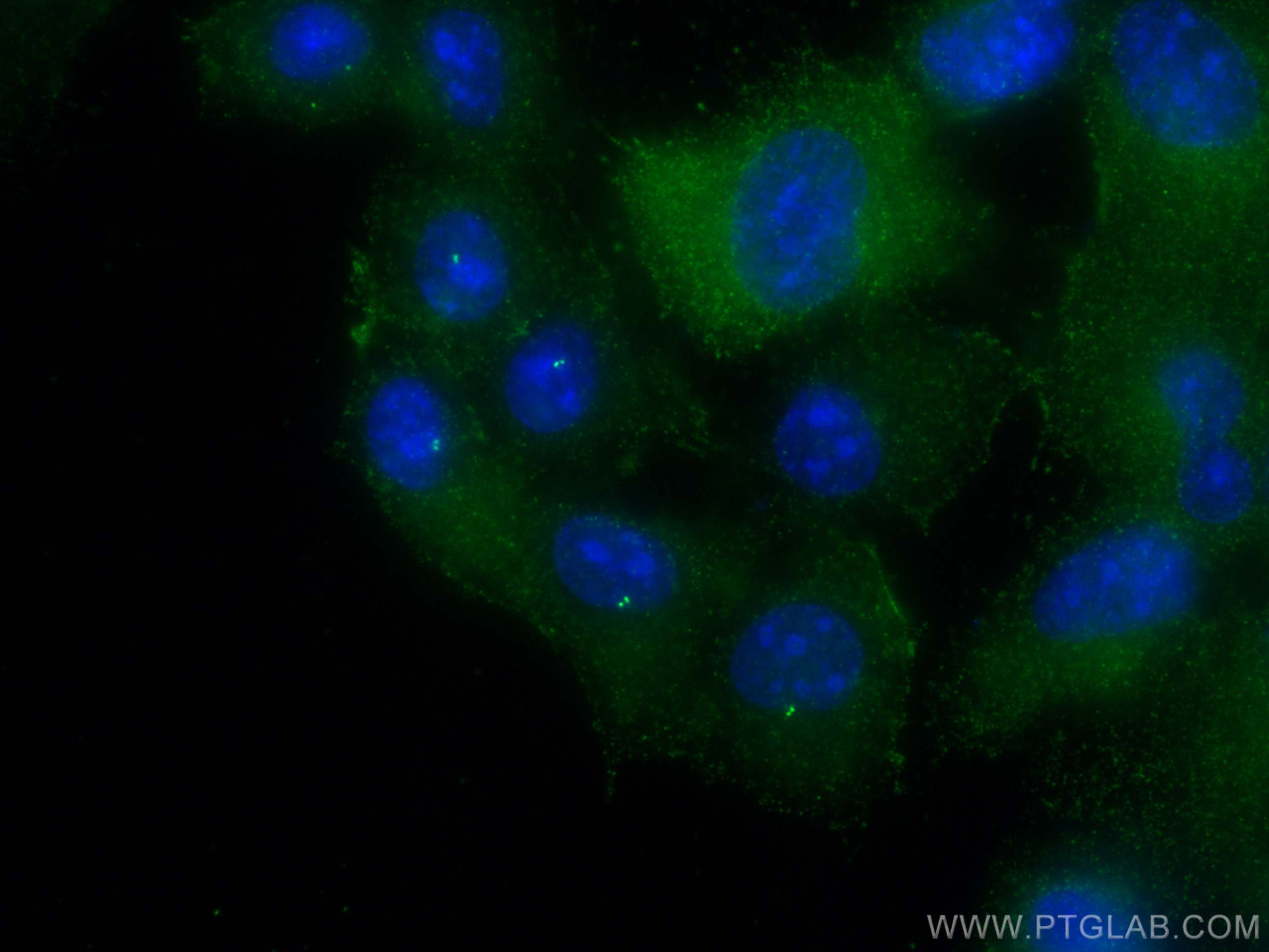 Immunofluorescence (IF) / fluorescent staining of hTERT-RPE1 cells using CEP63 Monoclonal antibody (66996-1-Ig)
